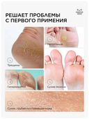 Средство для педикюра 