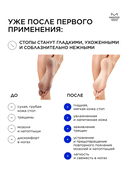 Средство для педикюра 