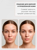 Сыворотка для лица 