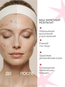 Крем антивозрастной миниатюра 