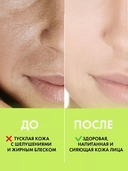 Тоник для лица 